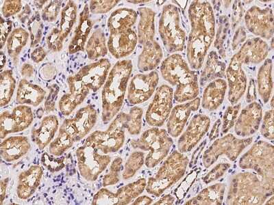 Immunohistochemistry-Paraffin: AKAP10 Antibody [NBP2-98506]