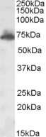 Western Blot: AKAP10 Antibody [NB100-94882]