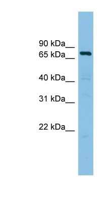 Western Blot: AKAP10 Antibody [NBP1-56509]