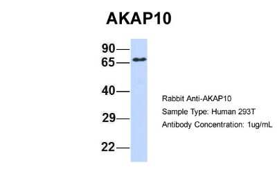 Western Blot: AKAP10 Antibody [NBP1-56509]