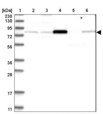 Western Blot: AKAP10 Antibody [NBP1-85314]