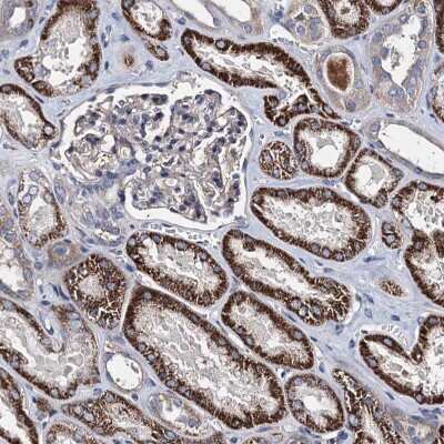 Immunohistochemistry-Paraffin: AKAP11 Antibody [NBP1-89169]