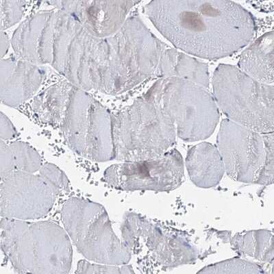 Immunohistochemistry-Paraffin: AKAP11 Antibody [NBP1-89169]