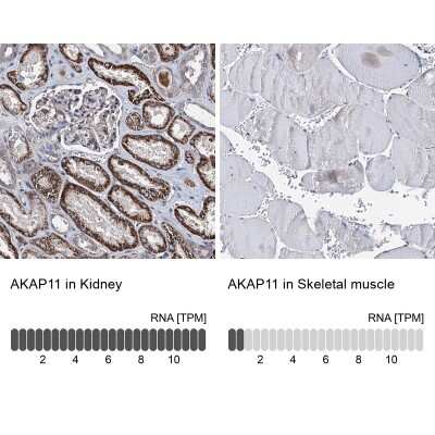 Immunohistochemistry-Paraffin: AKAP11 Antibody [NBP1-89169]