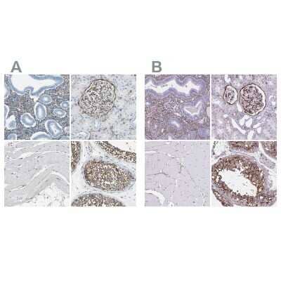 Immunohistochemistry-Paraffin: AKAP12 Antibody [NBP1-89168]
