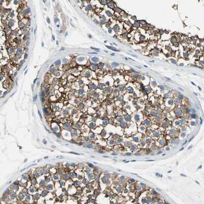 Immunohistochemistry-Paraffin: AKAP12 Antibody [NBP1-89168]