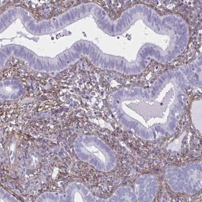 Immunohistochemistry-Paraffin: AKAP12 Antibody [NBP2-38786]