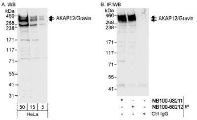 Western Blot: AKAP12 Antibody [NB100-68211]