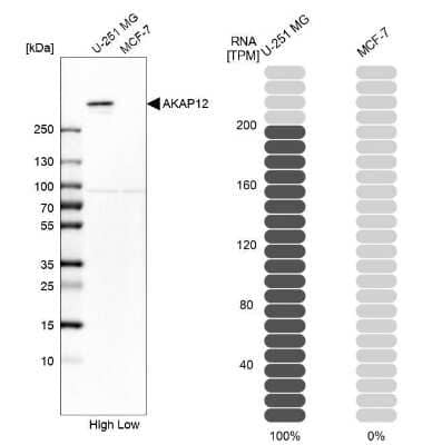 Western Blot: AKAP12 Antibody [NBP1-89168]