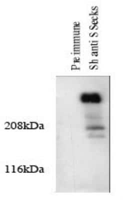 Western Blot: AKAP12 Antibody [NBP2-66604]