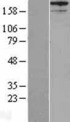 Western Blot: AKAP12 Overexpression Lysate [NBL1-07426]