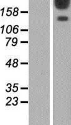 Western Blot: AKAP12 Overexpression Lysate [NBP2-07793]