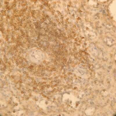 Immunohistochemistry-Paraffin: AKAP13 Antibody (3D6) [H00011214-M10]