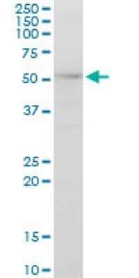 Western Blot: AKAP13 Antibody (3D6) [H00011214-M10]