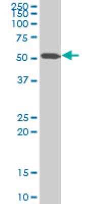 Western Blot: AKAP13 Antibody (3D6) [H00011214-M10]