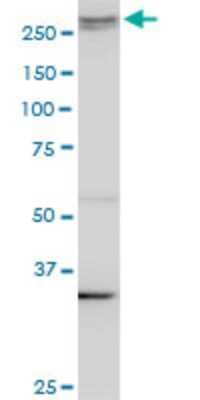 Western Blot: AKAP13 Antibody (3D6) [H00011214-M10]