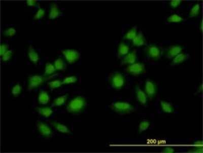 Immunocytochemistry/ Immunofluorescence: AKAP13 Antibody (5B7) [H00011214-M01]