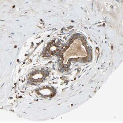 Immunohistochemistry-Paraffin: AKAP13 Antibody [NBP1-89163]
