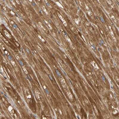 Immunohistochemistry-Paraffin: AKAP13 Antibody [NBP1-89163]