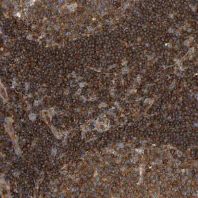 Immunohistochemistry-Paraffin: AKAP13 Antibody [NBP1-89163]