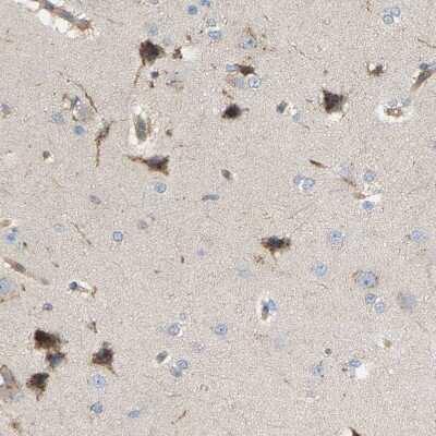 Immunohistochemistry-Paraffin: AKAP13 Antibody [NBP1-89163]