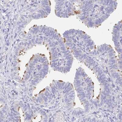 Immunohistochemistry-Paraffin: AKAP14 Antibody [NBP2-32580]