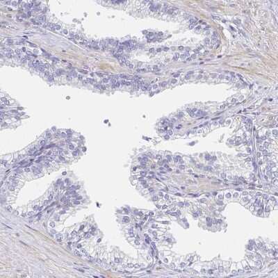 Immunohistochemistry-Paraffin: AKAP14 Antibody [NBP2-32580]