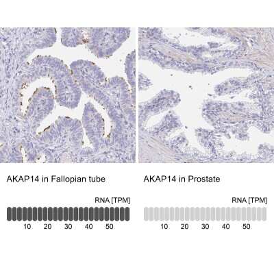 Immunohistochemistry-Paraffin: AKAP14 Antibody [NBP2-32580]