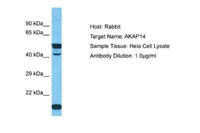 Western Blot: AKAP14 Antibody [NBP2-84412]