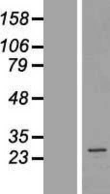 Western Blot: AKAP14 Overexpression Lysate [NBL1-07427]