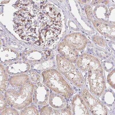 Immunohistochemistry-Paraffin: AKAP2 Antibody [NBP2-32404]