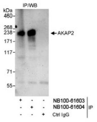 Immunoprecipitation: AKAP2 Antibody [NB100-61604]