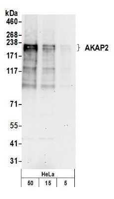 Western Blot: AKAP2 Antibody [NB100-61603]