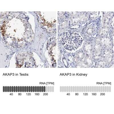 Immunohistochemistry-Paraffin: AKAP3 Antibody [NBP1-89173]