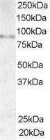 Western Blot: AKAP3 Antibody [NB100-1411]