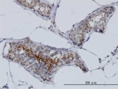 Immunohistochemistry-Paraffin: AKAP4 Antibody (4C10) [H00008852-M02]