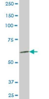 Western Blot: AKAP4 Antibody (4G1) [H00008852-M10]