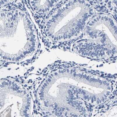 Immunohistochemistry-Paraffin: AKAP4 Antibody [NBP1-89164]