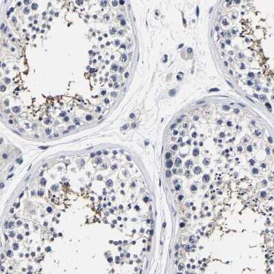 Immunohistochemistry-Paraffin: AKAP4 Antibody [NBP1-89164]