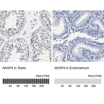 Immunohistochemistry-Paraffin: AKAP4 Antibody [NBP1-89164]