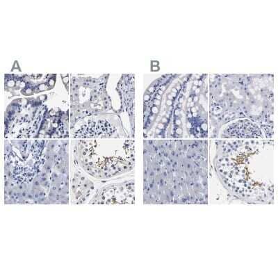 Immunohistochemistry-Paraffin: AKAP4 Antibody [NBP1-89164]