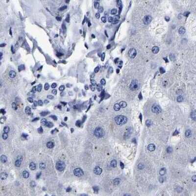 Immunohistochemistry-Paraffin: AKAP4 Antibody [NBP1-89164]