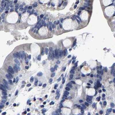 Immunohistochemistry-Paraffin: AKAP4 Antibody [NBP1-89164]