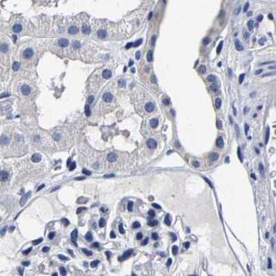 Immunohistochemistry-Paraffin: AKAP4 Antibody [NBP1-89164]