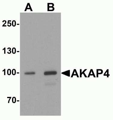 Western Blot: AKAP4 AntibodyBSA Free [NBP2-81946]