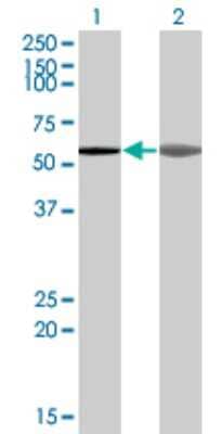 Western Blot: AKAP5 Antibody (1A9) [H00009495-M04]