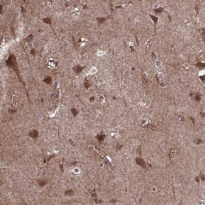 Immunohistochemistry: AKAP5 Antibody [NBP2-38713]