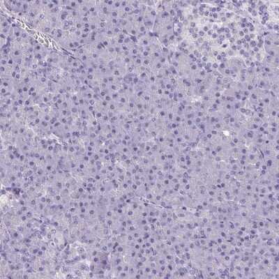 Immunohistochemistry-Paraffin: AKAP5 Antibody [NBP2-38713]