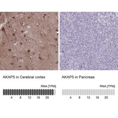 Immunohistochemistry-Paraffin: AKAP5 Antibody [NBP2-38713]