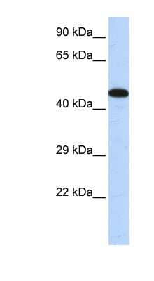 Western Blot: AKAP5 Antibody [NBP1-54807]